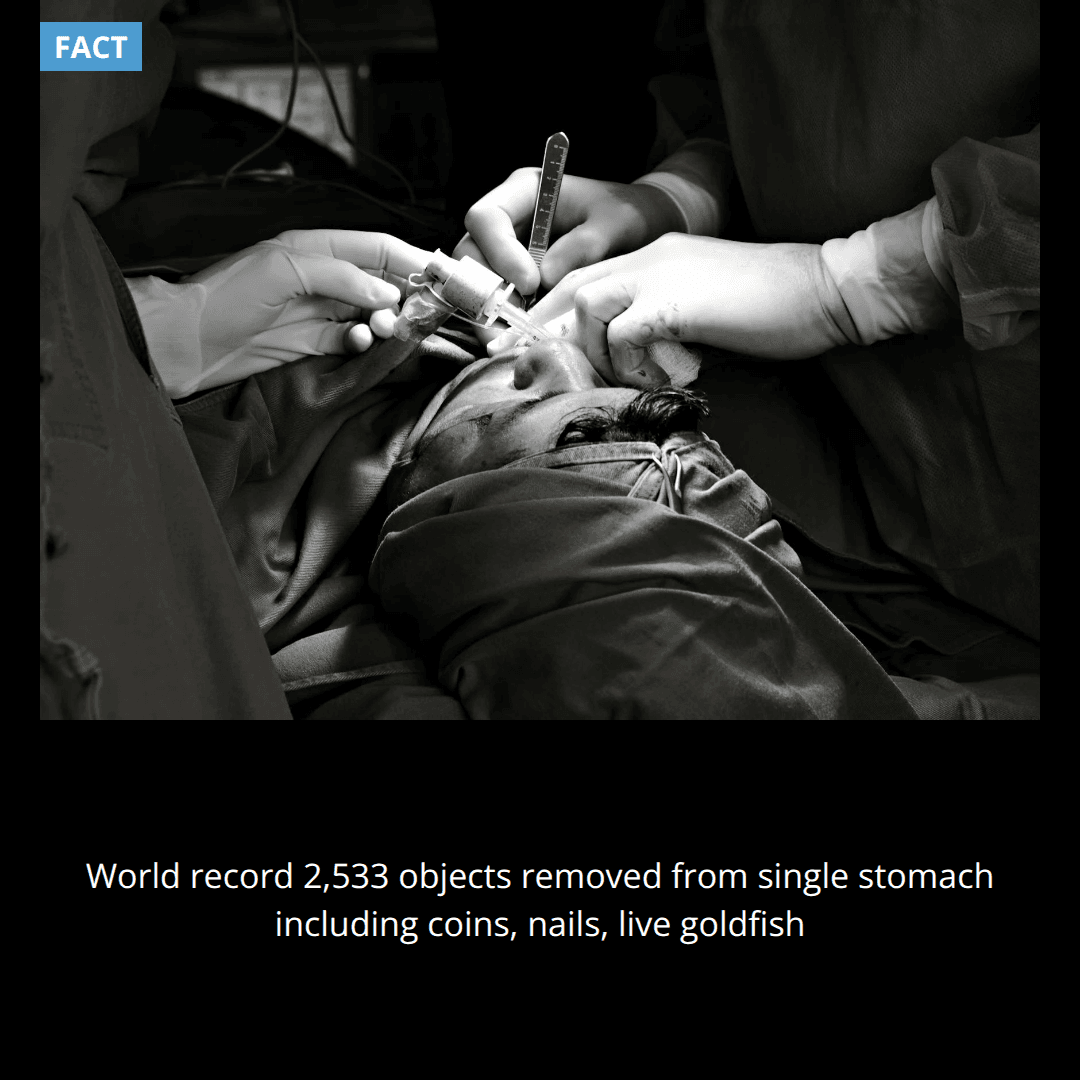 The world record for most objects removed from a single person's stomach is 2,533 items including coins, nails, and a live goldfish.