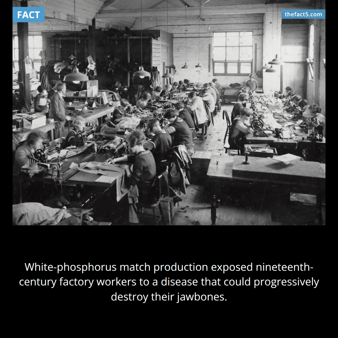 Ordinary matches once destroyed workers’ jawbones. 🔥